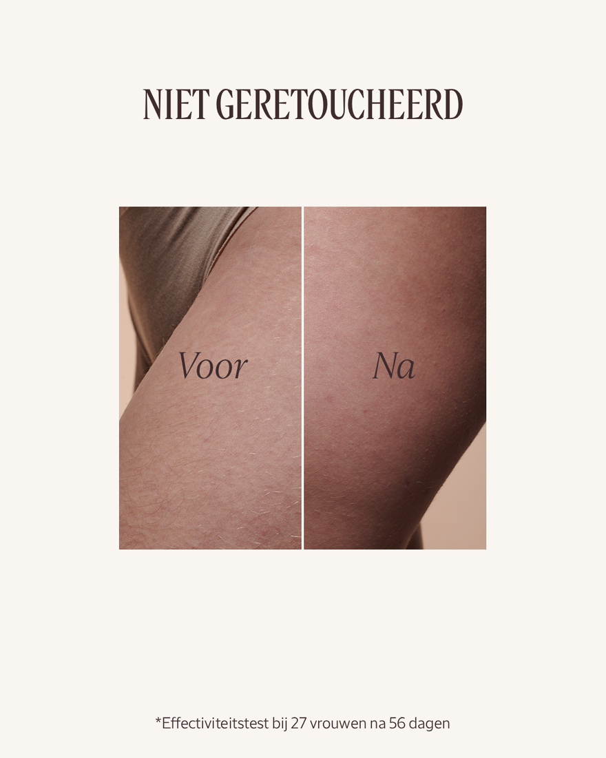 Weergave afbeelding 6/8 van product Almond Versoepelende Olie, , RECT
