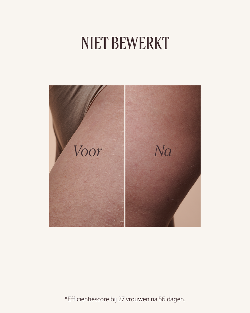 Weergave afbeelding 3/11 van product Almond Versoepelende Olie, , RECT
